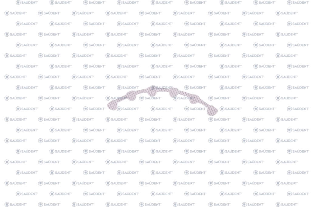 RETENEDOR LINGUAL MAXILAR 32mm 1 PZ