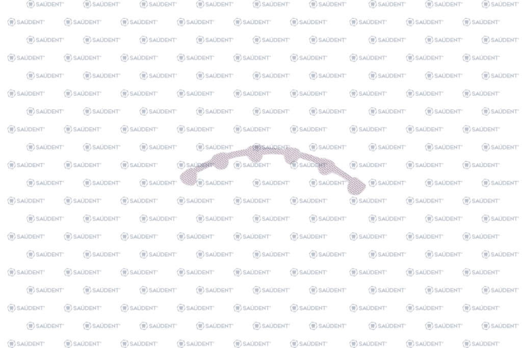 RETENEDOR LINGUAL MAXILAR 47mm 1 PZ