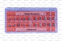 BRACKETS ALEXANDER 0.018 20PZ/PACK