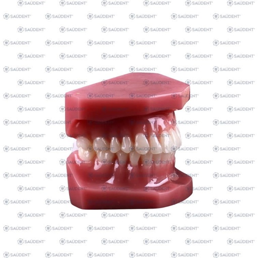 [55774] TIPODONTO ACRILICO NATURAL SIN BRACKETS 1PZ